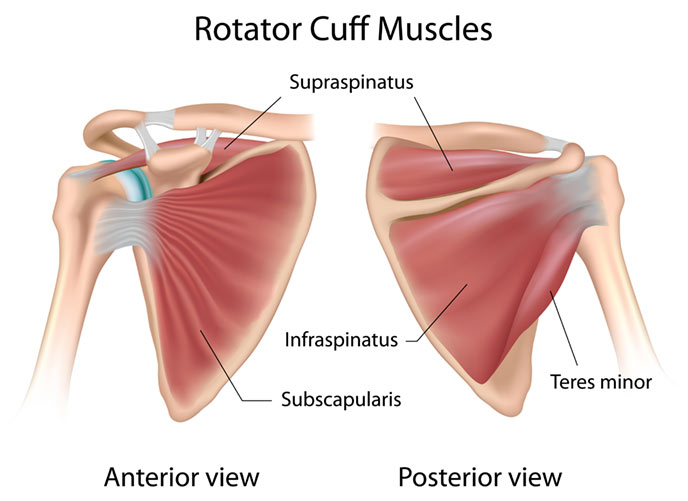 tratamentul rupturii tendonului mușchiului supraspinat al articulației umărului